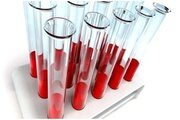 О биохимическом исследовании крови