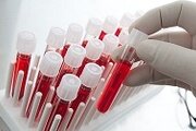О биохимических исследованиях сыворотки крови животных