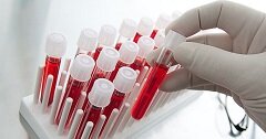 О биохимических исследованиях сыворотки крови животных