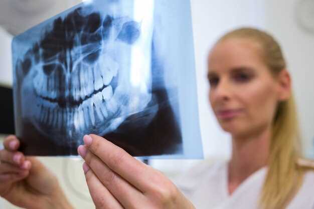 Переломы малой берцовой кости: причины и виды