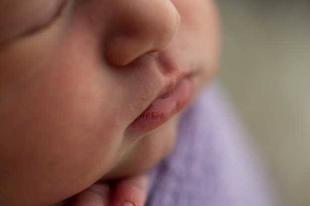 Методы лечения и ухода за сухими губами у младенца